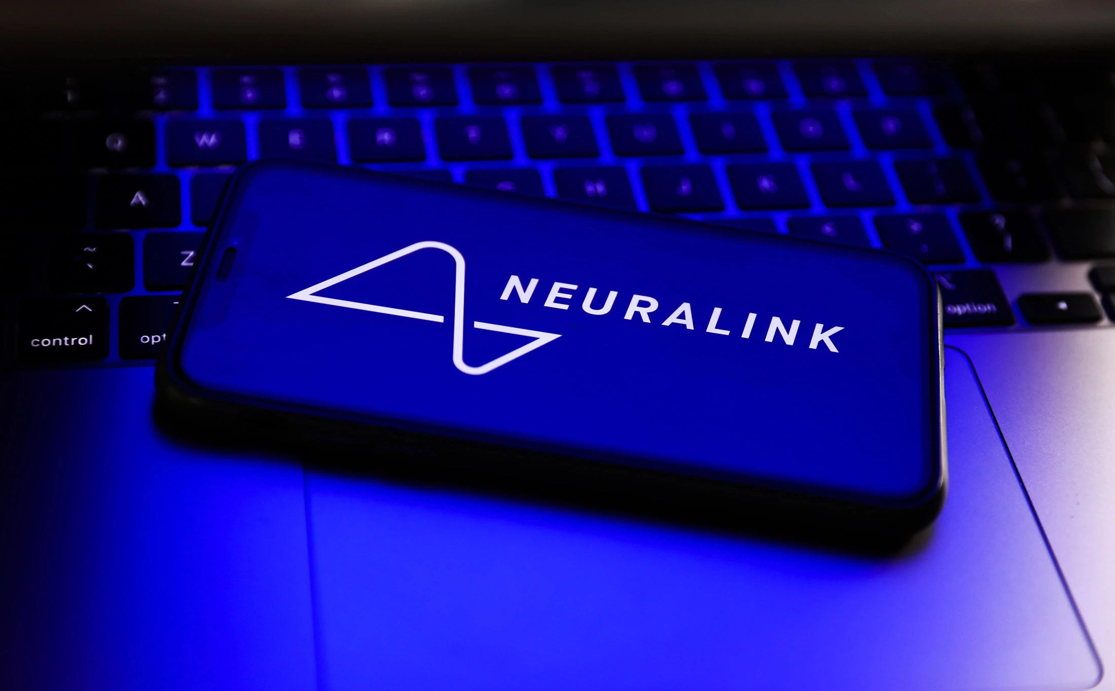 Neuralink is being investigated for reportedly transferring infected implants.